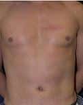 After Image