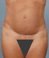 After Image