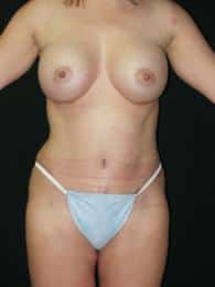 After Image