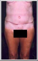 After Image