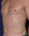 After Image