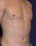 After Image