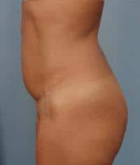 After Image