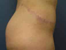 After Image