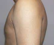 After Image