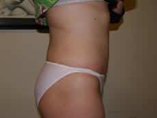 After Image