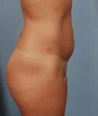 After Image