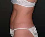 After Image