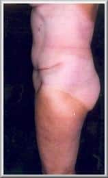 After Image