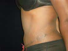 After Image