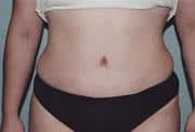 After Image