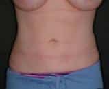 After Image