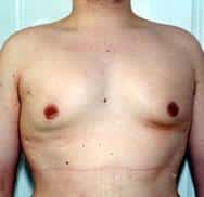 After Image