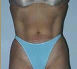 After Image