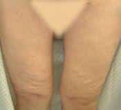After Image
