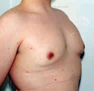 After Image