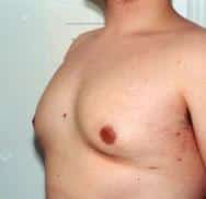 After Image