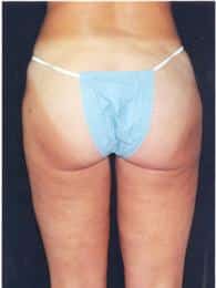 After Image