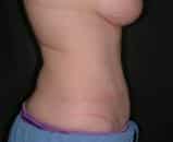 After Image