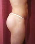 After Image