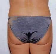 After Image