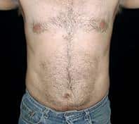 After Image