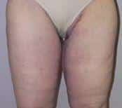 After Image
