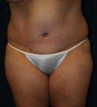 After Image