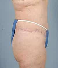 After Image