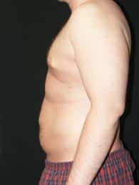 After Image