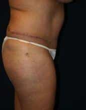 After Image