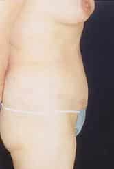 After Image