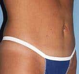 After Image