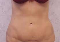 After Image