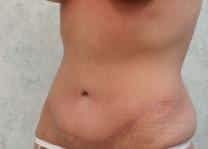 After Image