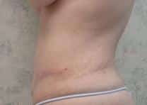 After Image