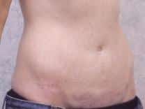 After Image