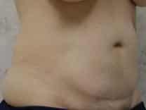 After Image