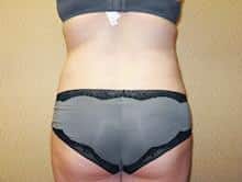 After Image
