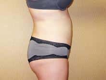 After Image