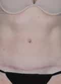 After Image