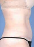 After Image