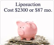 ls plastic surgery financing banr